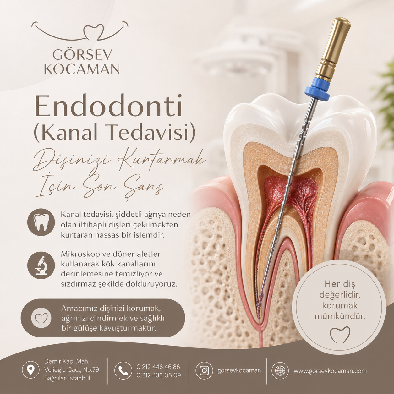 Instagram Gönderisi
